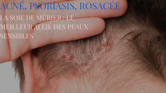 Soie &  peau fragile : une alliance précieuse contre l’acné, l’eczéma… et bien plus encore